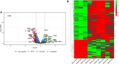 Proteomics and lipidomic analysis reveal dysregulated pathways associated with loss of sacsin